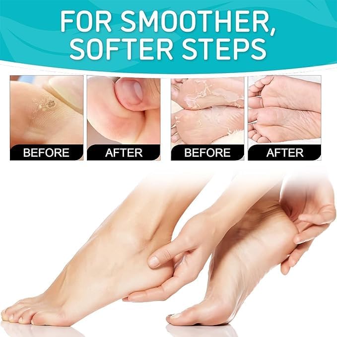 Peeling & Exfoliating Foot Mask for Baby Soft Feet Hydrates Feet Peeling Mask