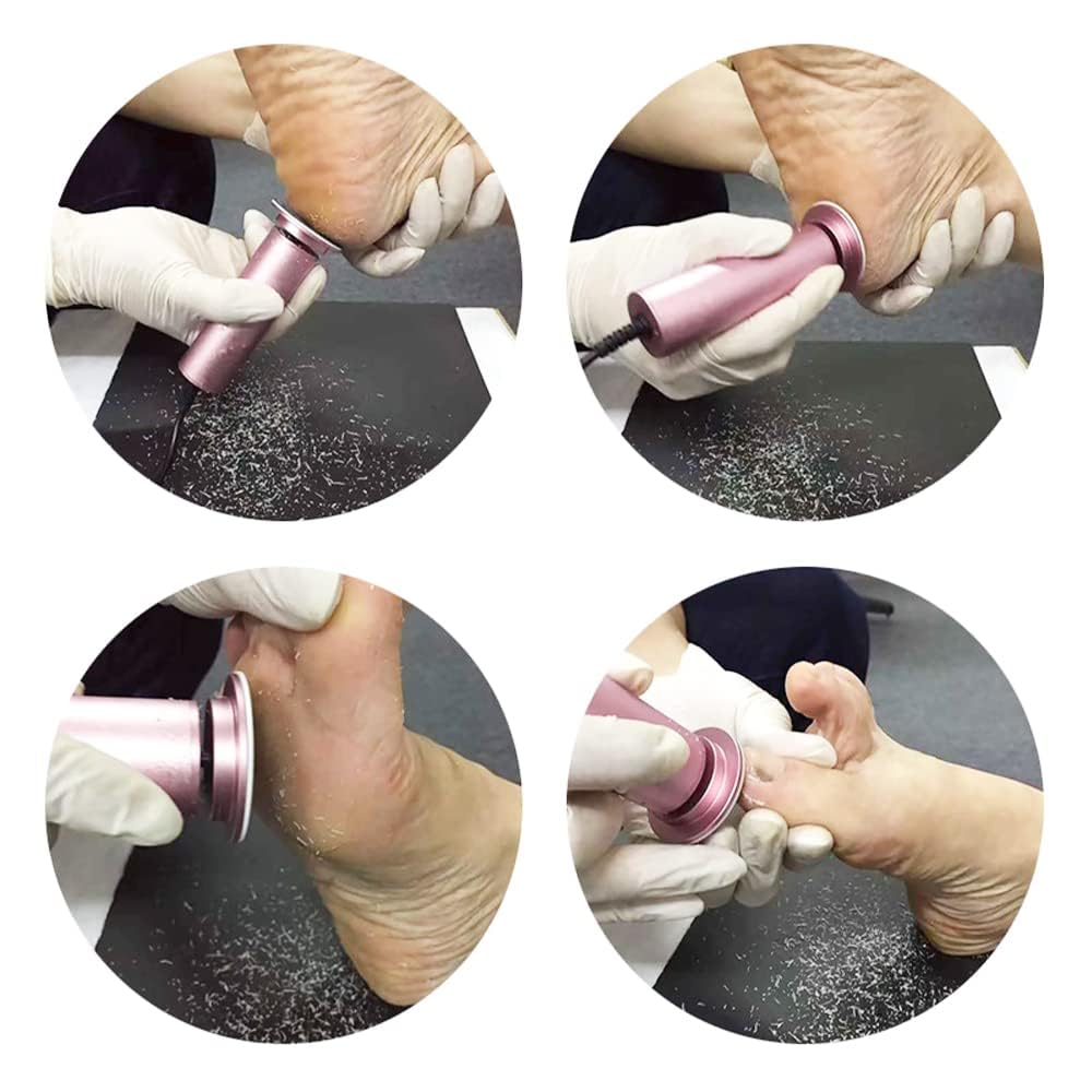 Electric Foot Scrubber For Dead Skin Remover