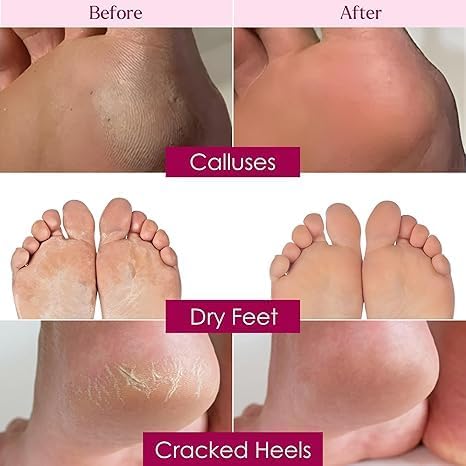 Peeling & Exfoliating Foot Mask for Baby Soft Feet Hydrates Feet Peeling Mask (Rose), 1 Count