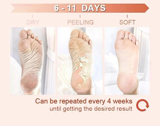 Peeling & Exfoliating Foot Mask for Baby Soft Feet Hydrates Feet Peeling Mask (Rose), 1 Count