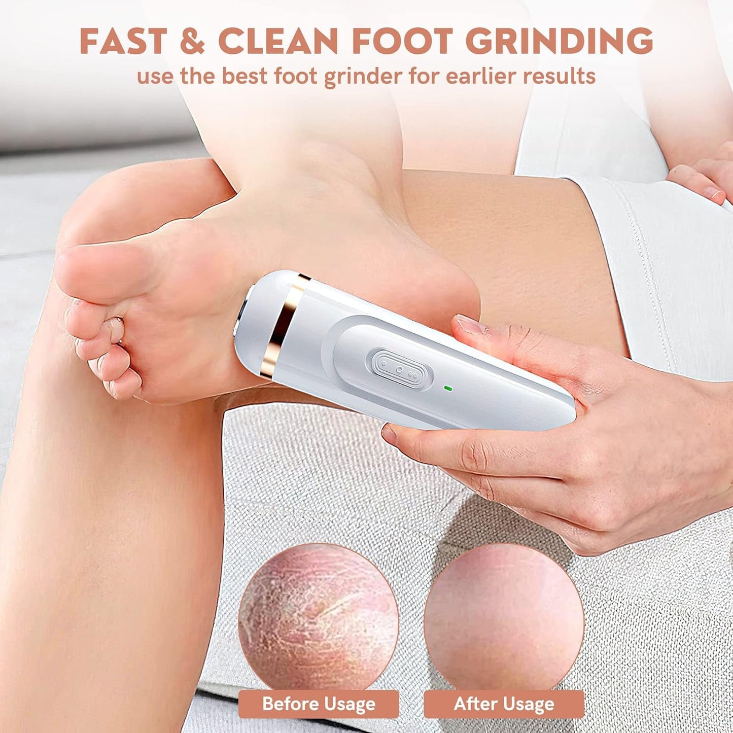 Electric Foot/Heel Scrubber & Callus Remover – Rechargeable