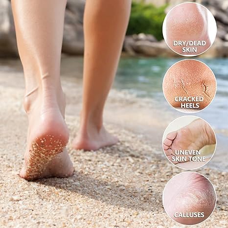 Peeling & Exfoliating Foot Mask for Baby Soft Feet Hydrates Feet Peeling Mask (Rose), 1 Count