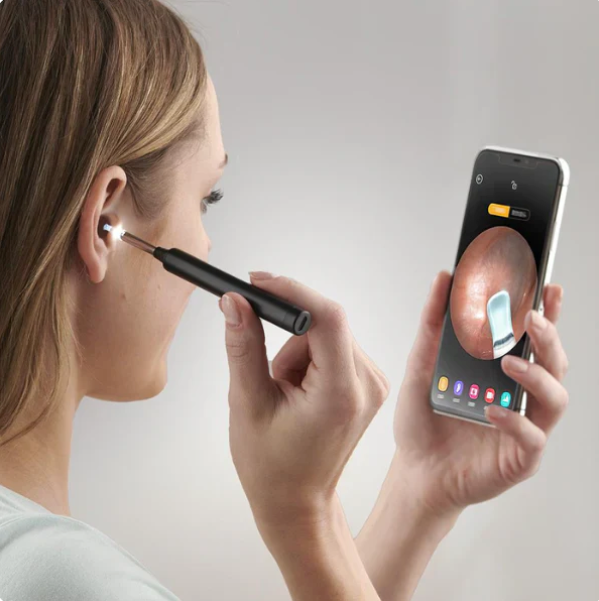 Ear Wax Cleaner Kit with HD WiFi Camera – Reusable Otoscope Tool