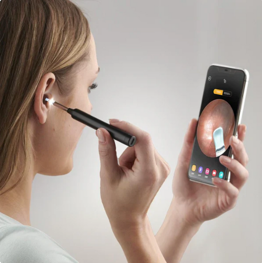 Ear Wax Cleaner Kit with HD WiFi Camera – Reusable Otoscope Tool