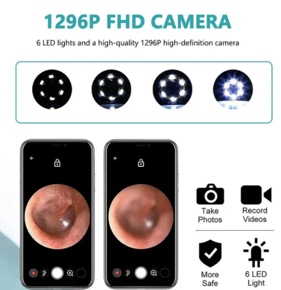 Ear Wax Cleaner Kit with HD WiFi Camera – Reusable Otoscope Tool