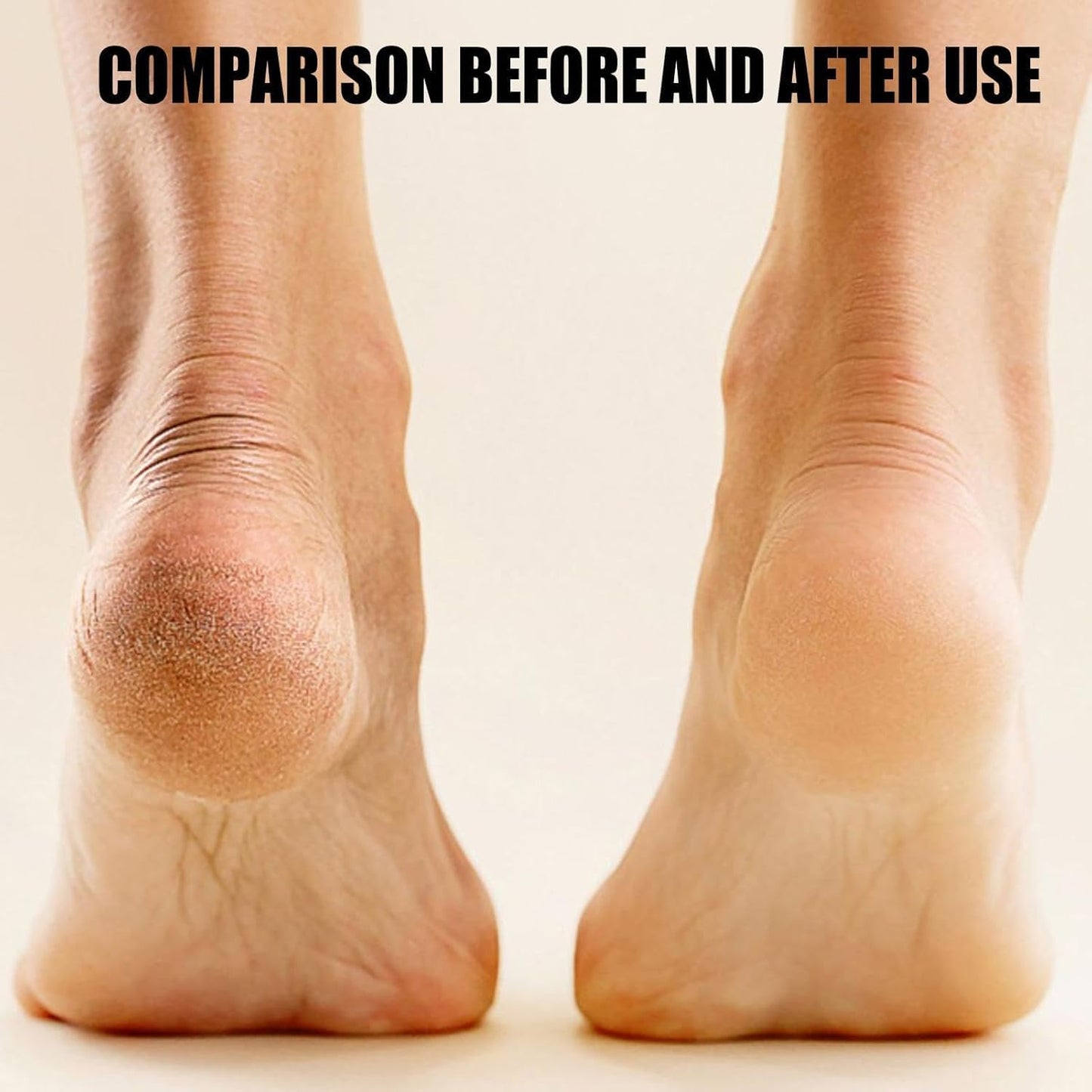 Electric callus remover for feet - Rechargeable Foot